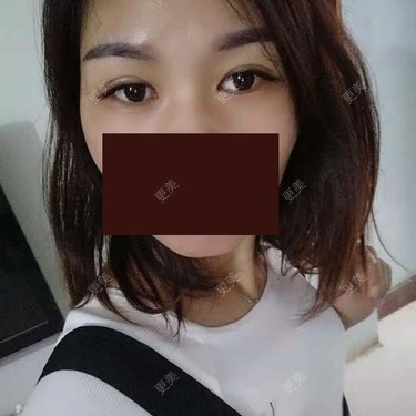 杨丽 医生