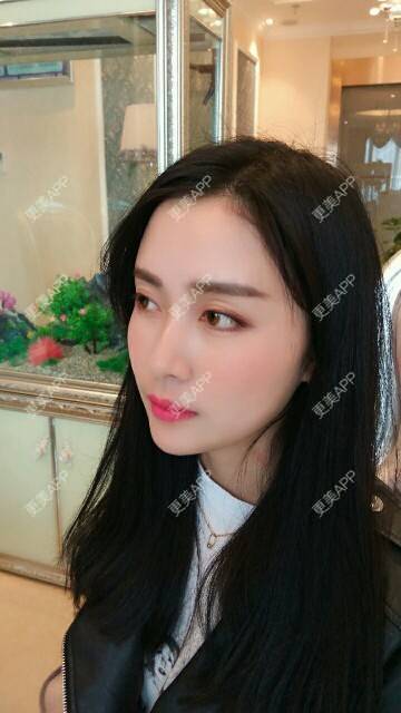 更美 - 心中始终有你的玻尿酸下巴经验 | 玻尿酸下巴 | 硅胶垫下巴 | 膨体垫下巴 | 缩下巴 | 成都