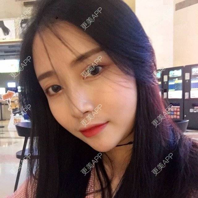 更美 - 心中始终有你的玻尿酸下巴经验 | 玻尿酸下巴 | 硅胶垫下巴 | 膨体垫下巴 | 缩下巴 | 成都