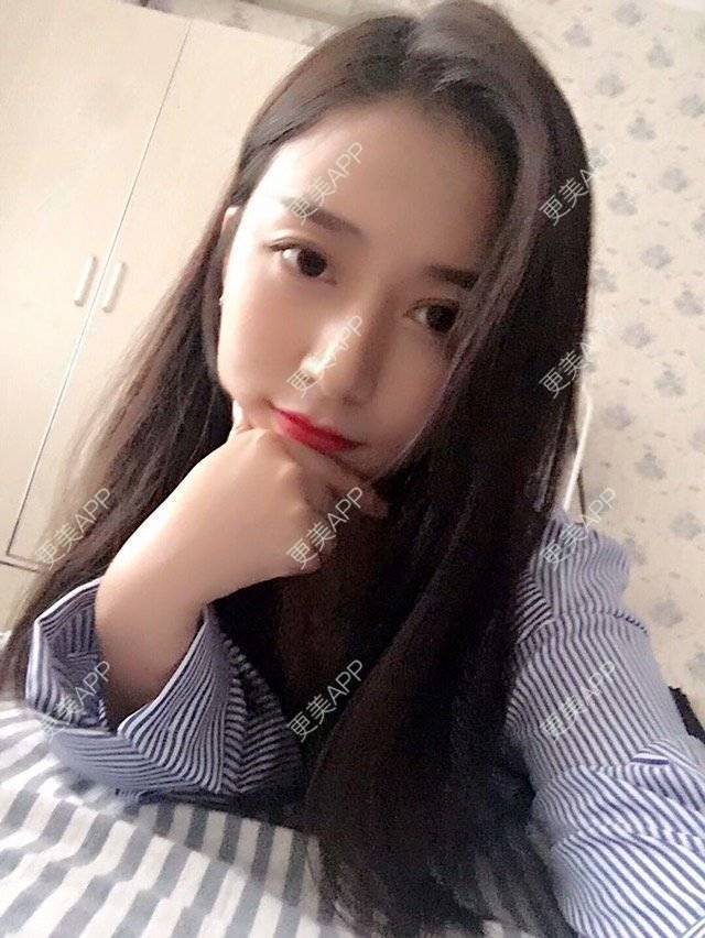 更美 - 心中始终有你的玻尿酸下巴经验 | 玻尿酸下巴 | 硅胶垫下巴 | 膨体垫下巴 | 缩下巴 | 成都