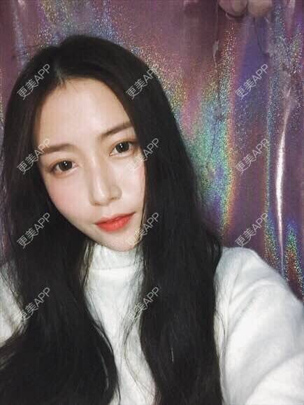 更美 - 心中始终有你的玻尿酸下巴经验 | 玻尿酸下巴 | 硅胶垫下巴 | 膨体垫下巴 | 缩下巴 | 成都