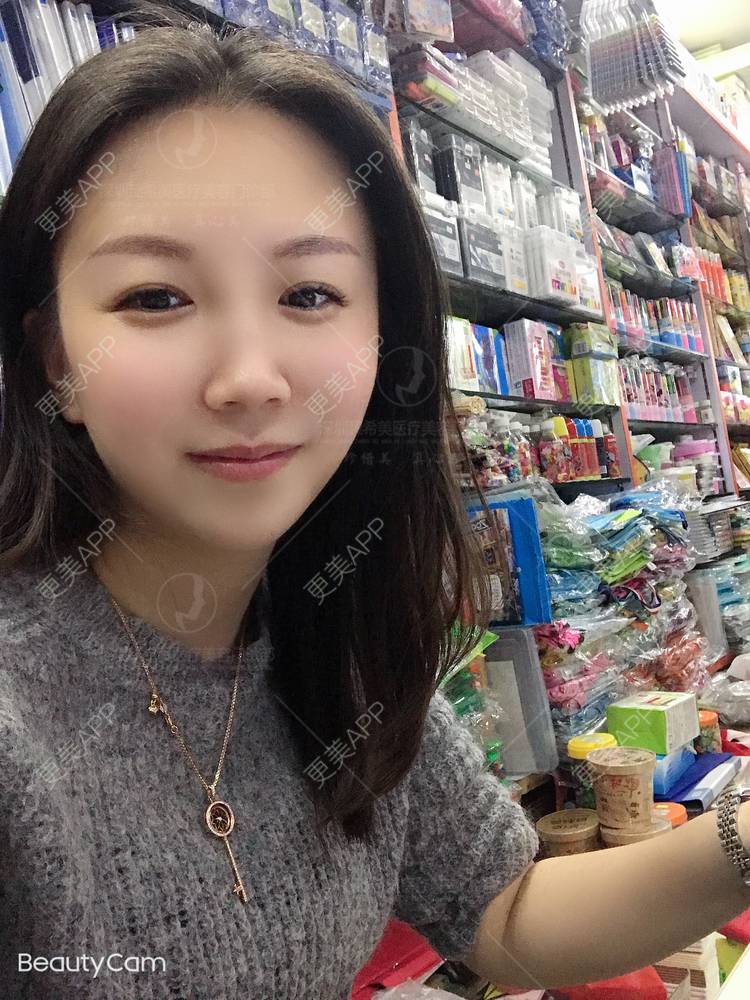 更美 - 杨宝宝😊啊的埋线提升经验 | 埋线提升 | 深圳