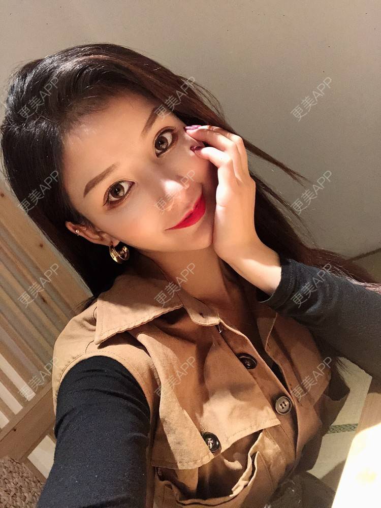 更美 - 双子座的小易的隆鼻经验 | 隆鼻 | 手术缩鼻头 | 长沙 | 鼻小柱延长 | 鼻形态修复 | 鼻部硅胶假体取出 | 耳软骨隆鼻