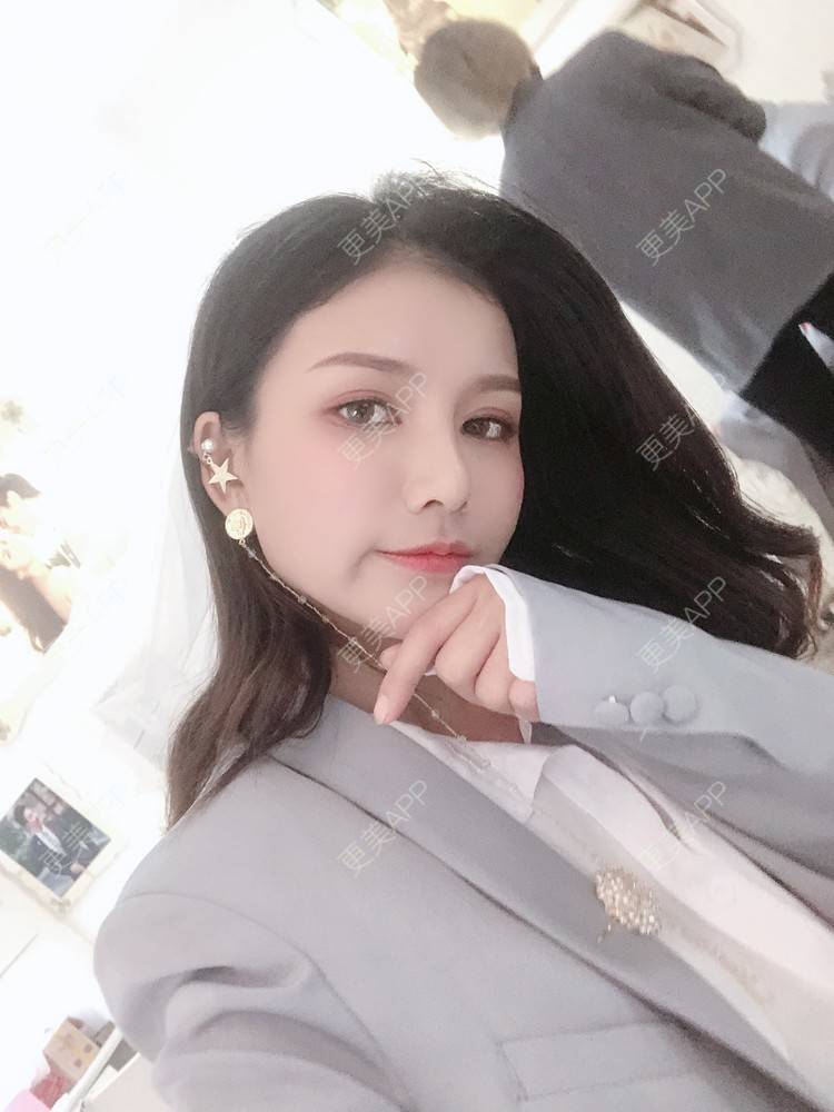 更美 - 双子座的小易的隆鼻经验 | 隆鼻 | 手术缩鼻头 | 长沙 | 鼻小柱延长 | 鼻形态修复 | 鼻部硅胶假体取出 | 耳软骨隆鼻