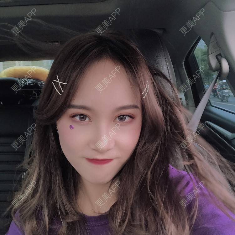 更美 - 半夏0的双眼皮经验 | 双眼皮 | 成都 | 大腿脱毛 | 更美研究所 | 视频日记