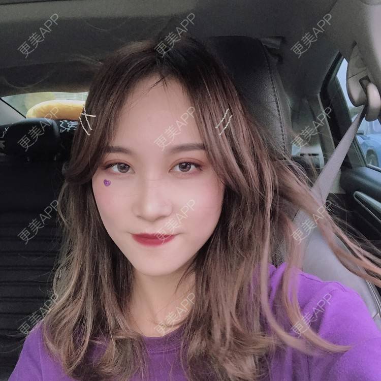 更美 - 半夏0的双眼皮经验 | 双眼皮 | 成都 | 大腿脱毛 | 更美研究所 | 视频日记