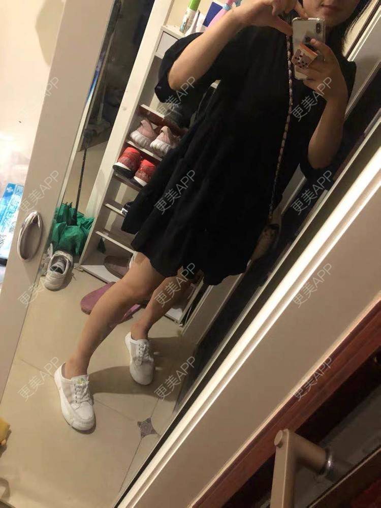 更美 - 秋风落叶。的手臂脱毛经验 | 手臂脱毛 | 大腿脱毛