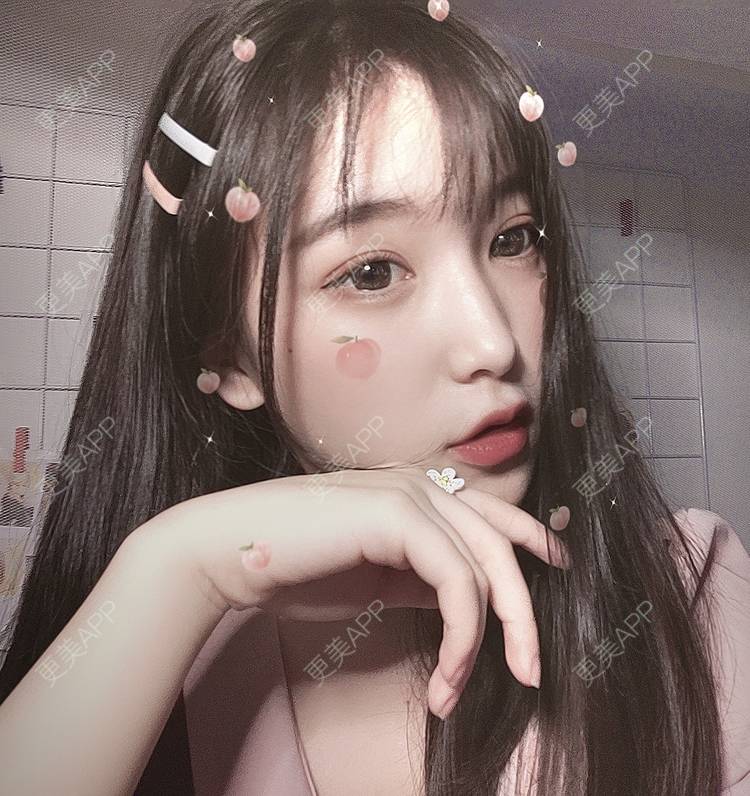 更美 - 更美用户F38SI0FUnA的埋线提升经验 | 埋线提升 | 东莞