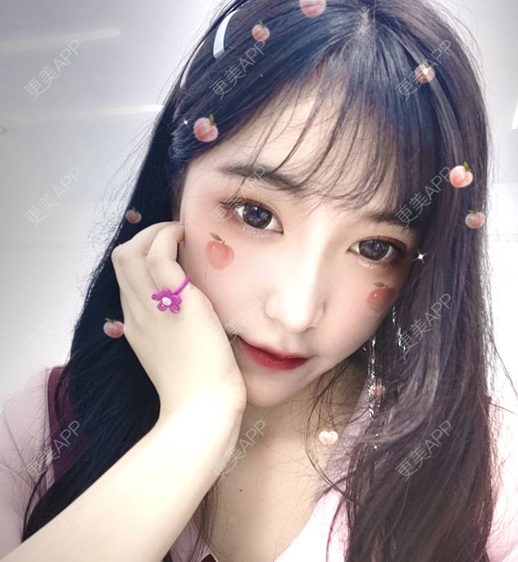 更美 - 更美用户F38SI0FUnA的埋线提升经验 | 埋线提升 | 东莞
