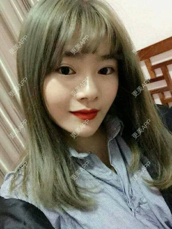 更美 - 更美用户TGYeipwLsJ的硅胶垫下巴经验 | 硅胶垫下巴 | 成都