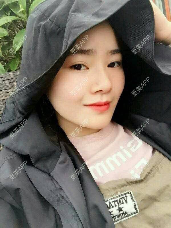 更美 - 更美用户TGYeipwLsJ的硅胶垫下巴经验 | 硅胶垫下巴 | 成都