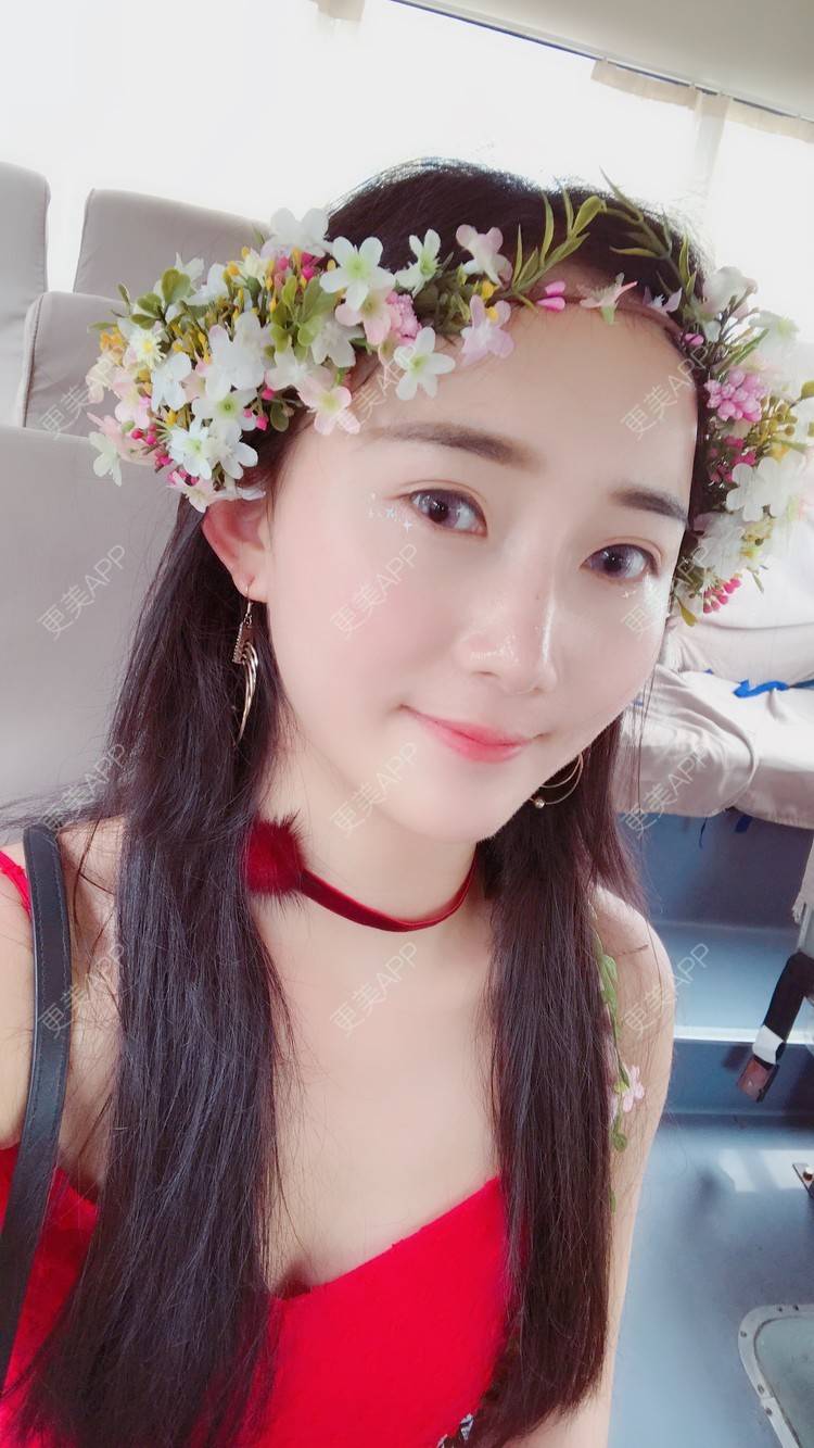 更美 - 卷毛甜心的自体脂肪填充泪沟经验 | 自体脂肪填充泪沟 | 视频日记 | 自体脂肪全面部填充 | 自体脂肪垫鼻基底 | 自体脂肪丰面颊 | 上海 | 自体脂肪垫下巴