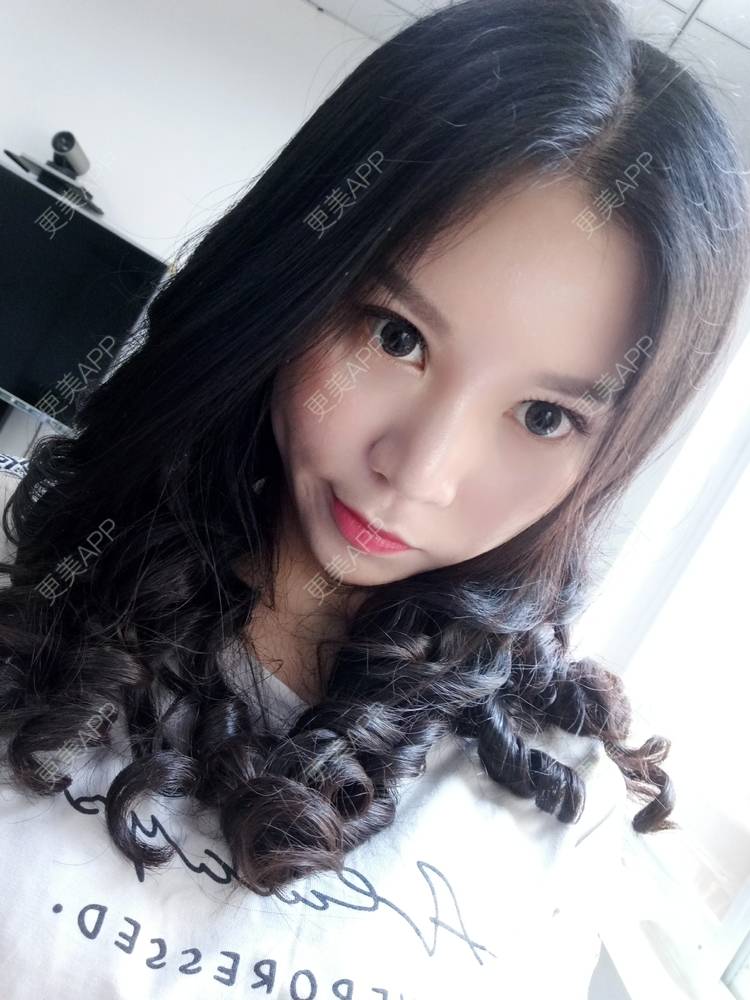 更美 - 更美用户PBaKwFJhkl的硅胶隆鼻经验 | 上海 | 硅胶隆鼻