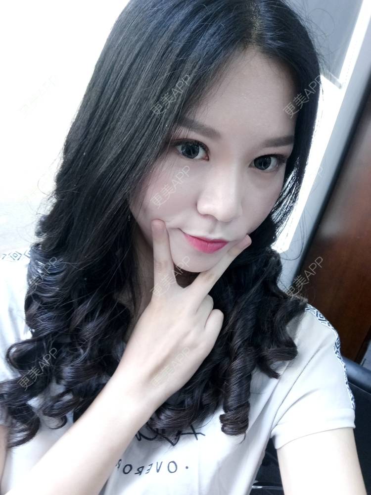 更美 - 更美用户PBaKwFJhkl的硅胶隆鼻经验 | 上海 | 硅胶隆鼻