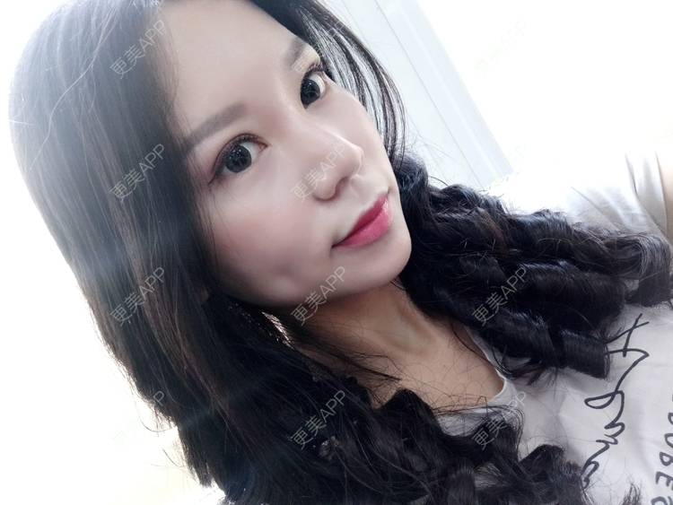 更美 - 更美用户PBaKwFJhkl的硅胶隆鼻经验 | 上海 | 硅胶隆鼻