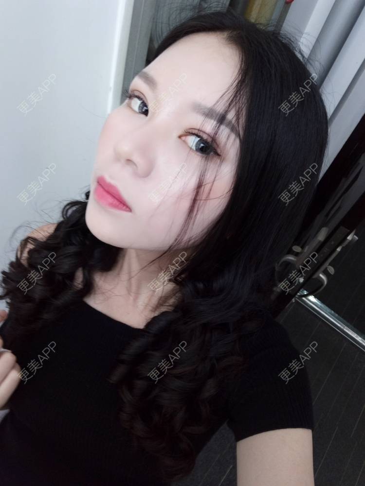 更美 - 更美用户PBaKwFJhkl的硅胶隆鼻经验 | 上海 | 硅胶隆鼻