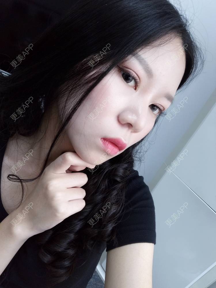更美 - 更美用户PBaKwFJhkl的硅胶隆鼻经验 | 上海 | 硅胶隆鼻
