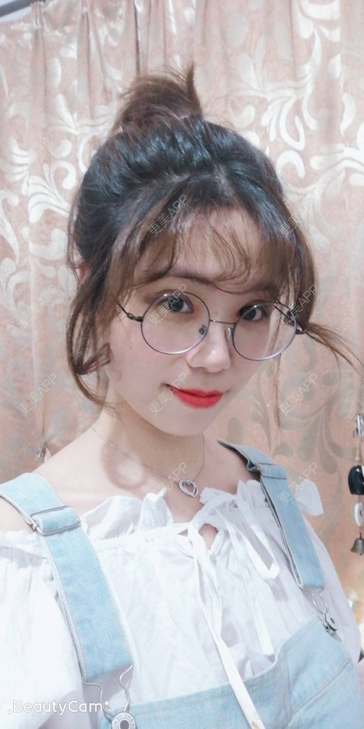 更美 - 墨七轩的双眼皮经验 | 双眼皮 | 全切双眼皮 | 开内眼角 | 开外眼角 | 杭州