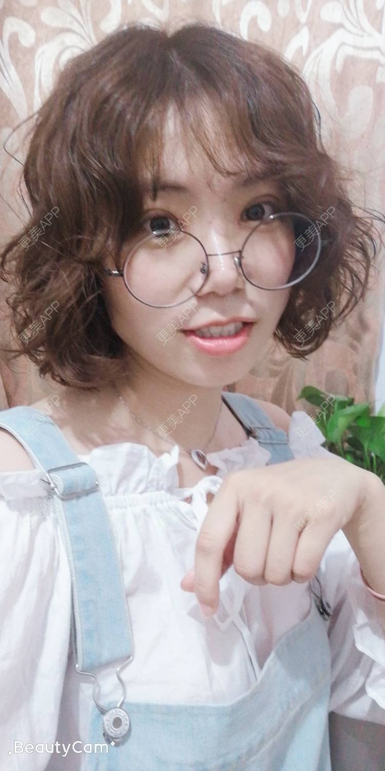 更美 - 墨七轩的双眼皮经验 | 双眼皮 | 全切双眼皮 | 开内眼角 | 开外眼角 | 杭州