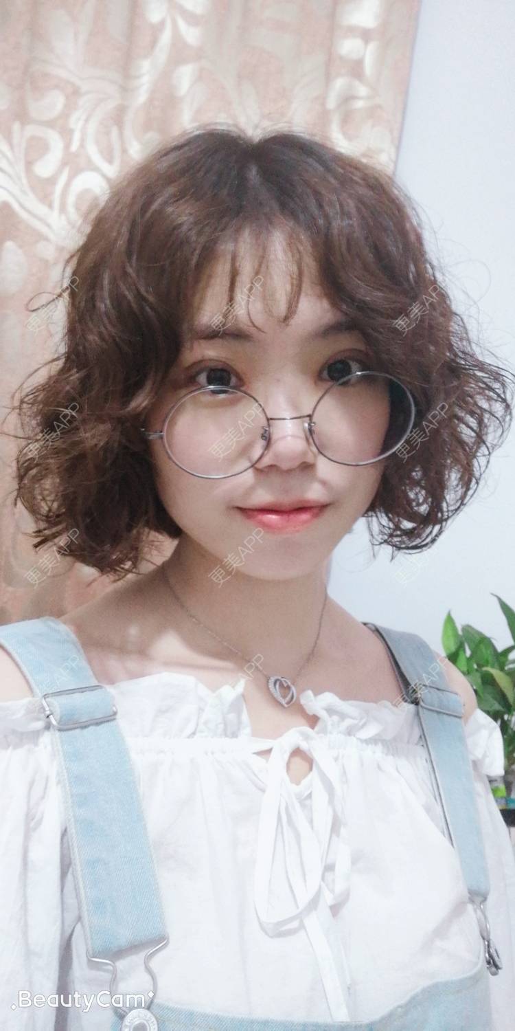 更美 - 墨七轩的双眼皮经验 | 双眼皮 | 全切双眼皮 | 开内眼角 | 开外眼角 | 杭州