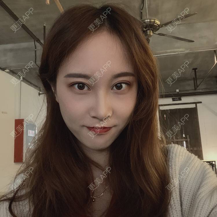 更美 - 半夏0的双眼皮经验 | 双眼皮 | 成都 | 大腿脱毛 | 更美研究所 | 视频日记