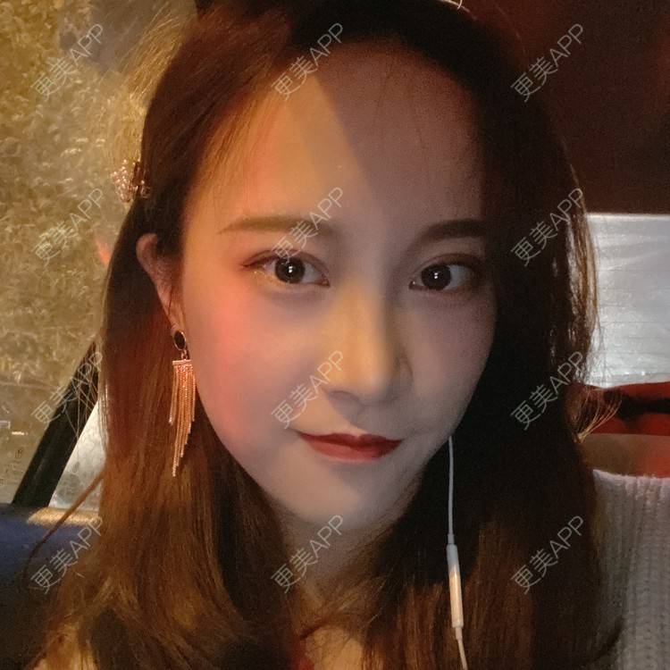 更美 - 半夏0的双眼皮经验 | 双眼皮 | 成都 | 大腿脱毛 | 更美研究所 | 视频日记