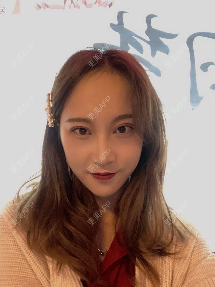 更美 - 半夏0的双眼皮经验 | 双眼皮 | 成都 | 大腿脱毛 | 更美研究所 | 视频日记