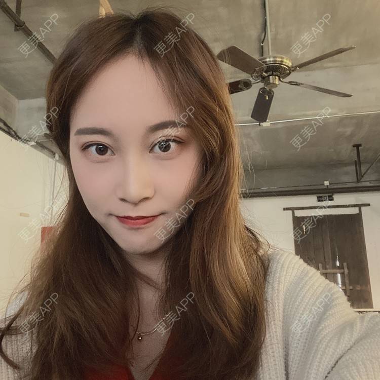 更美 - 半夏0的双眼皮经验 | 双眼皮 | 成都 | 大腿脱毛 | 更美研究所 | 视频日记