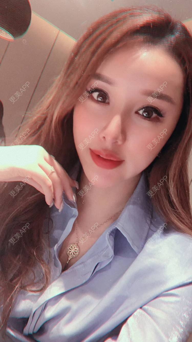 更美 - 更美用户kJbvl2QE4Y的除皱套餐经验 | 除皱套餐
