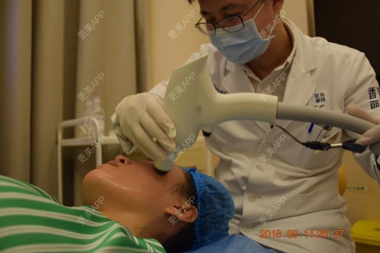 更美 - 更美用户M1Z1g3e73l的双下巴溶脂经验 | 双下巴溶脂