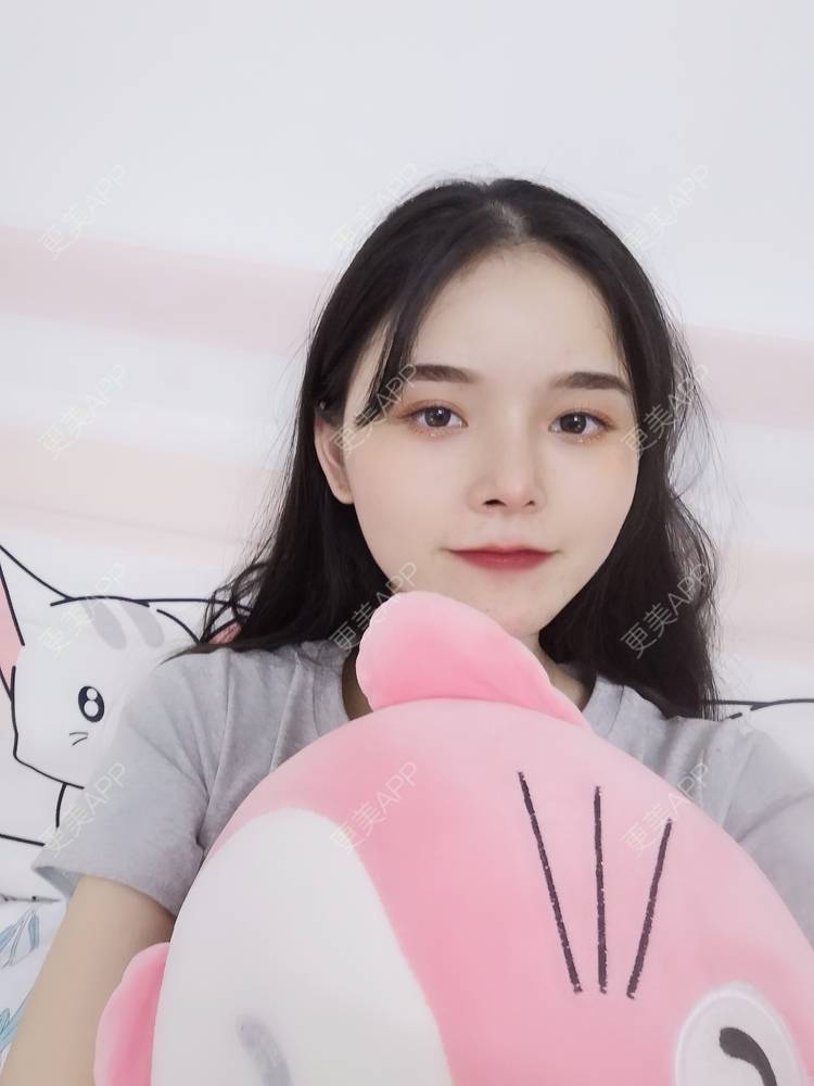 更美 - 莫宁🌸的自体脂肪填充泪沟经验 | 自体脂肪丰额头 | 自体脂肪填充泪沟 | 自体脂肪丰太阳穴 | 自体脂肪丰面颊 | 自体脂肪丰苹果肌 | 自体脂肪垫下巴 | 广州 | 视频日记