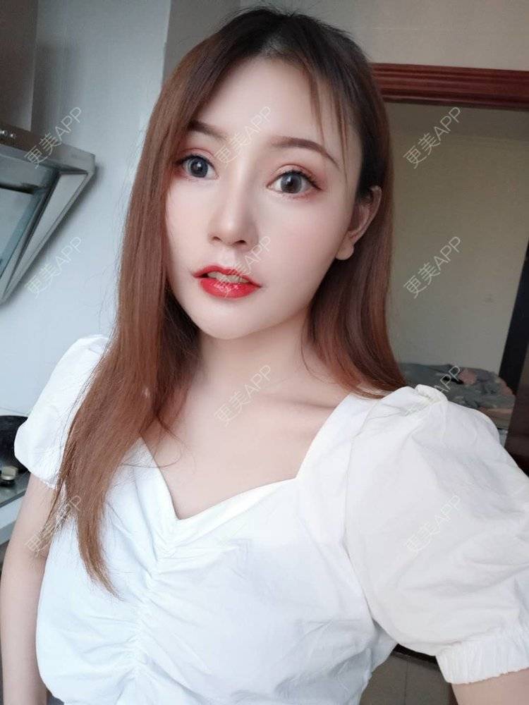 更美 - 更美用户U6Pt7ApV7A的吸脂瘦脸经验 | 吸脂瘦脸 | 重庆