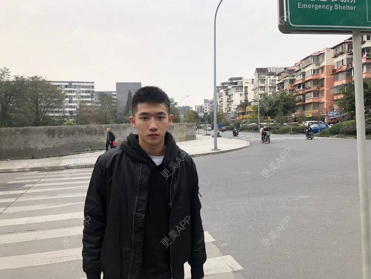 更美 - 仰望ooo的驼峰鼻矫正经验 | 北京 | 视频日记 | 驼峰鼻矫正