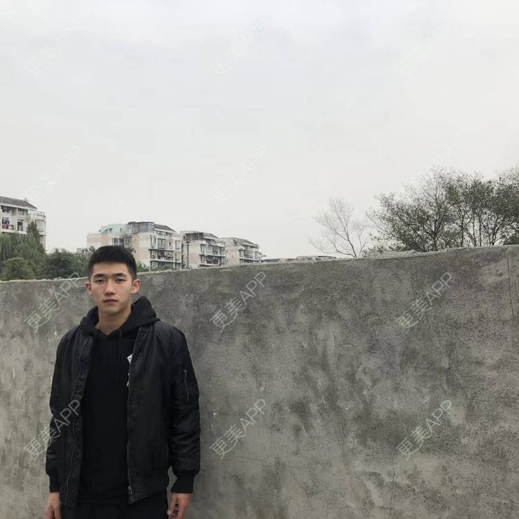 更美 - 仰望ooo的驼峰鼻矫正经验 | 北京 | 视频日记 | 驼峰鼻矫正