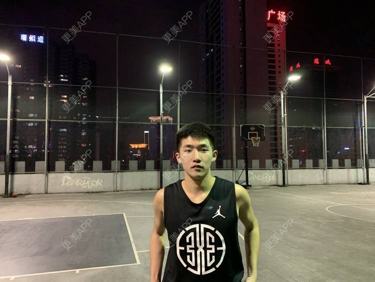 更美 - 仰望ooo的驼峰鼻矫正经验 | 北京 | 视频日记 | 驼峰鼻矫正