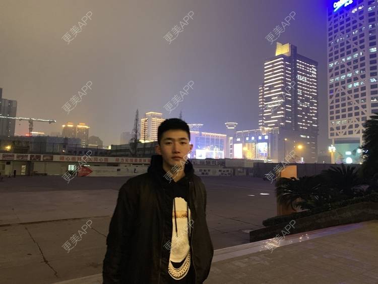 更美 - 仰望ooo的驼峰鼻矫正经验 | 北京 | 视频日记 | 驼峰鼻矫正