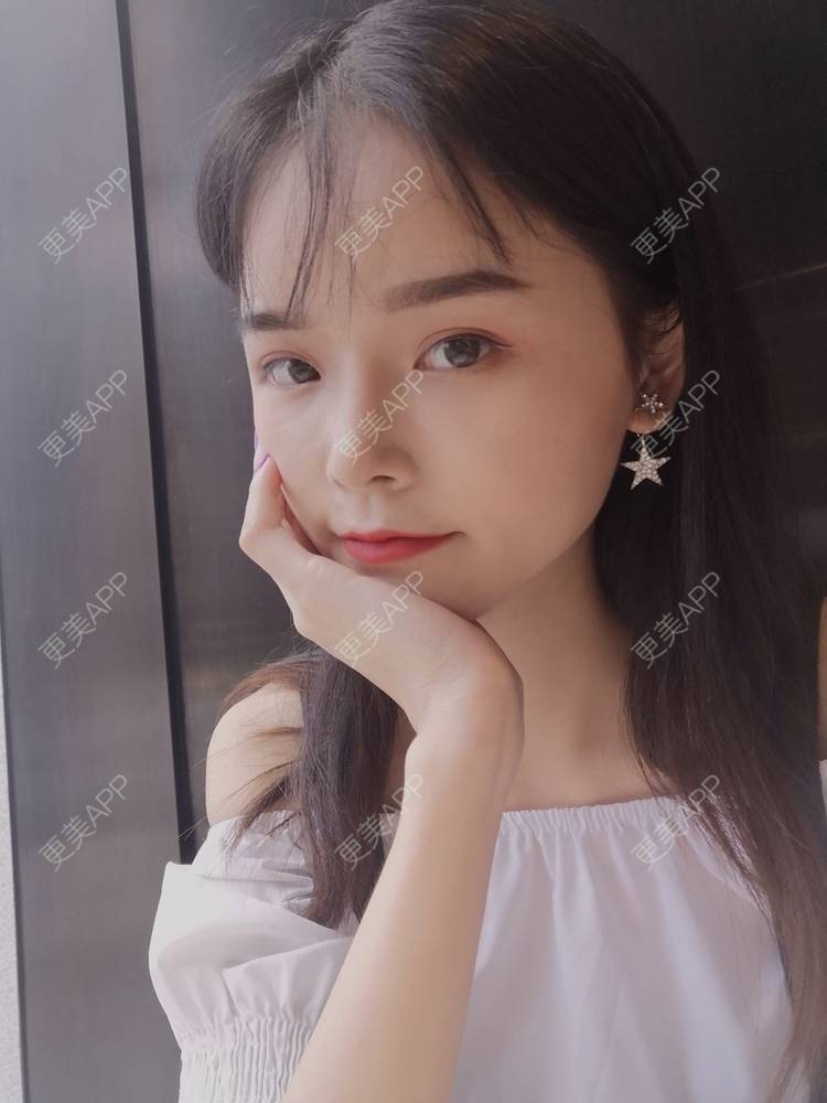 更美 - 莫宁🌸的自体脂肪填充泪沟经验 | 自体脂肪丰额头 | 自体脂肪填充泪沟 | 自体脂肪丰苹果肌 | 自体脂肪丰面颊 | 自体脂肪垫下巴 | 自体脂肪丰太阳穴 | 广州 | 视频日记