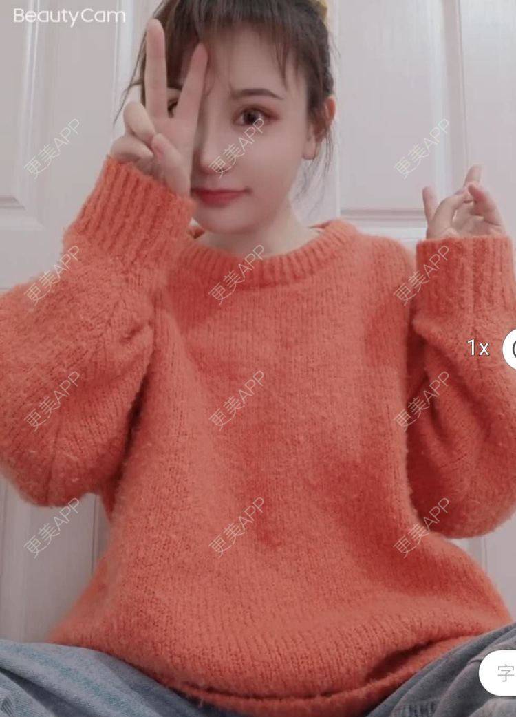 更美 - 更美用户U6Pt7ApV7A的吸脂瘦脸经验 | 吸脂瘦脸 | 重庆