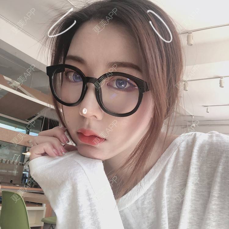 更美 - 薄情人゜缓的M唇成形经验 | M唇成形 | 武汉