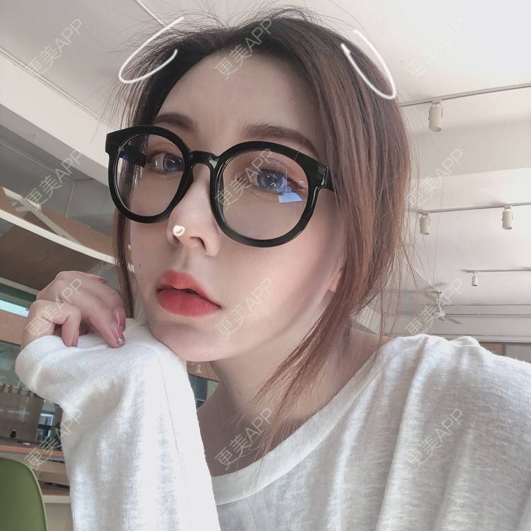 更美 - 薄情人゜缓的M唇成形经验 | M唇成形 | 武汉