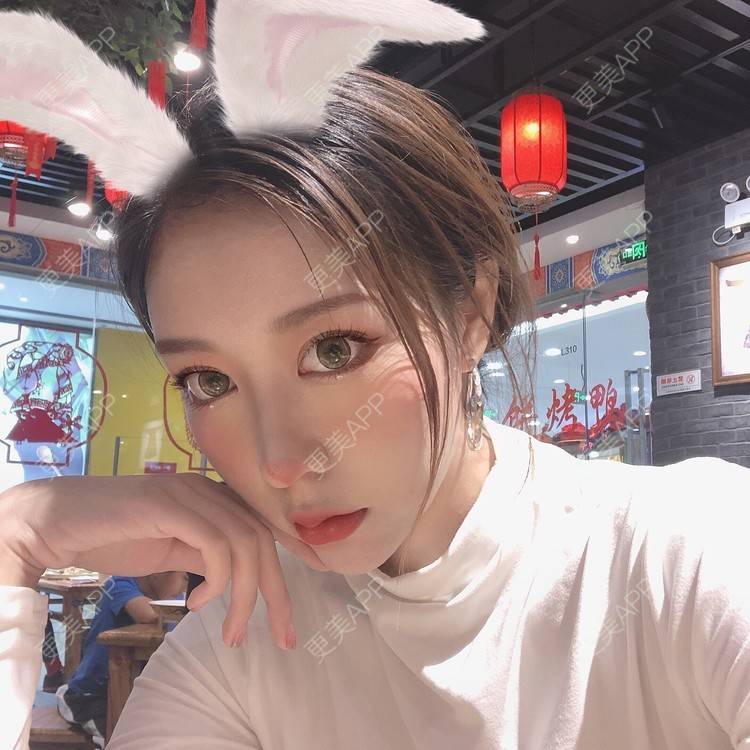 更美 - 薄情人゜缓的M唇成形经验 | M唇成形 | 武汉