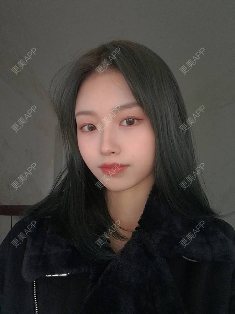 更美 - 不要奶茶的M唇成形经验 | M唇成形 | 杭州