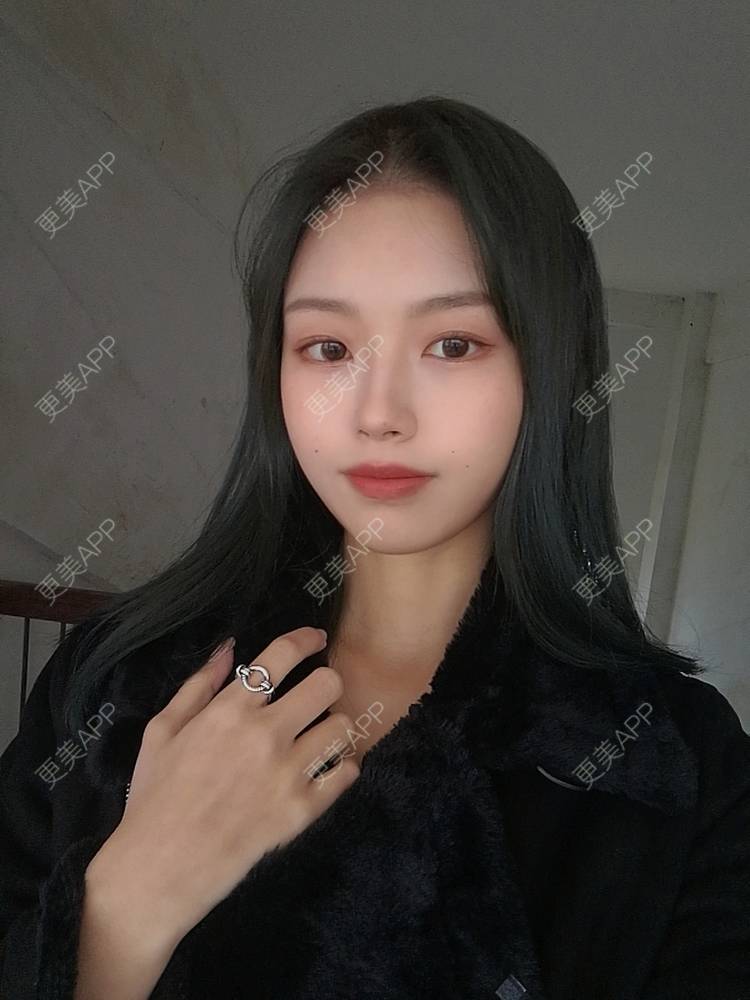 更美 - 不要奶茶的M唇成形经验 | M唇成形 | 杭州