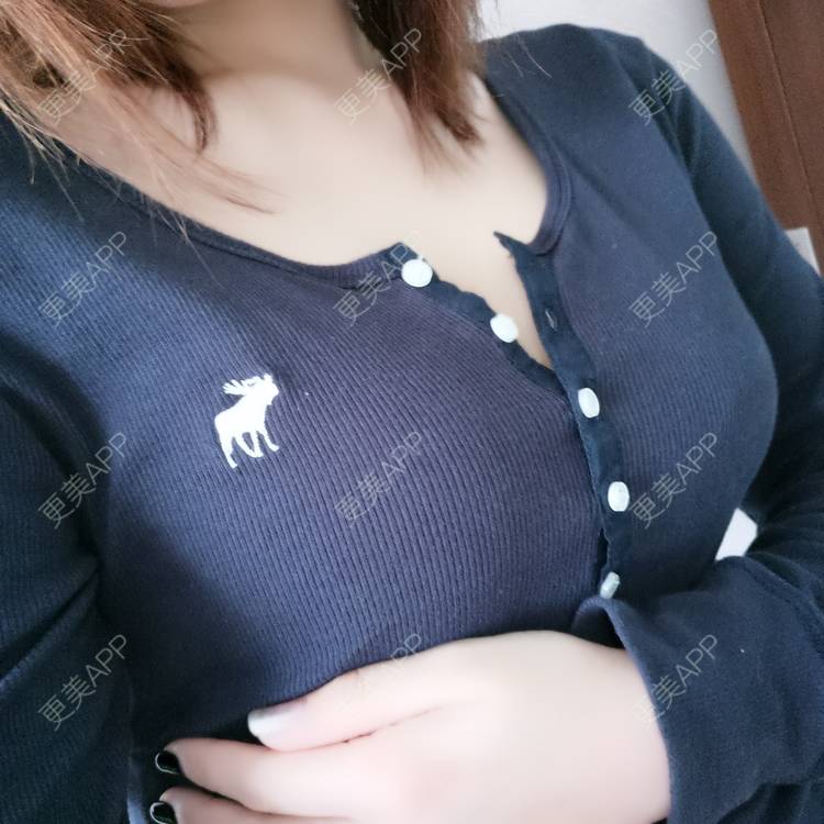 更美 - 更美用户Z6h08t4rXC的假体隆胸经验 | 上海 | 假体隆胸