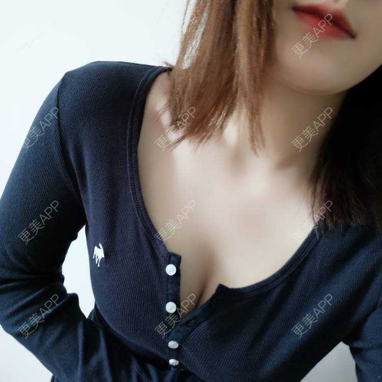 更美 - 更美用户Z6h08t4rXC的假体隆胸经验 | 上海 | 假体隆胸
