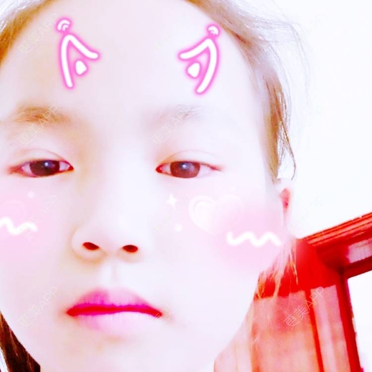 更美 - 更美用户bTokPQ65si的美白套餐经验 | 美白套餐 | 荆州