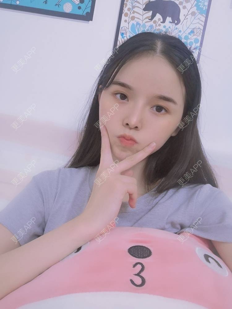 更美 - 莫宁🌸的自体脂肪填充泪沟经验 | 自体脂肪填充泪沟 | 自体脂肪丰太阳穴 | 自体脂肪丰苹果肌 | 自体脂肪丰面颊 | 自体脂肪垫下巴 | 自体脂肪丰额头 | 广州