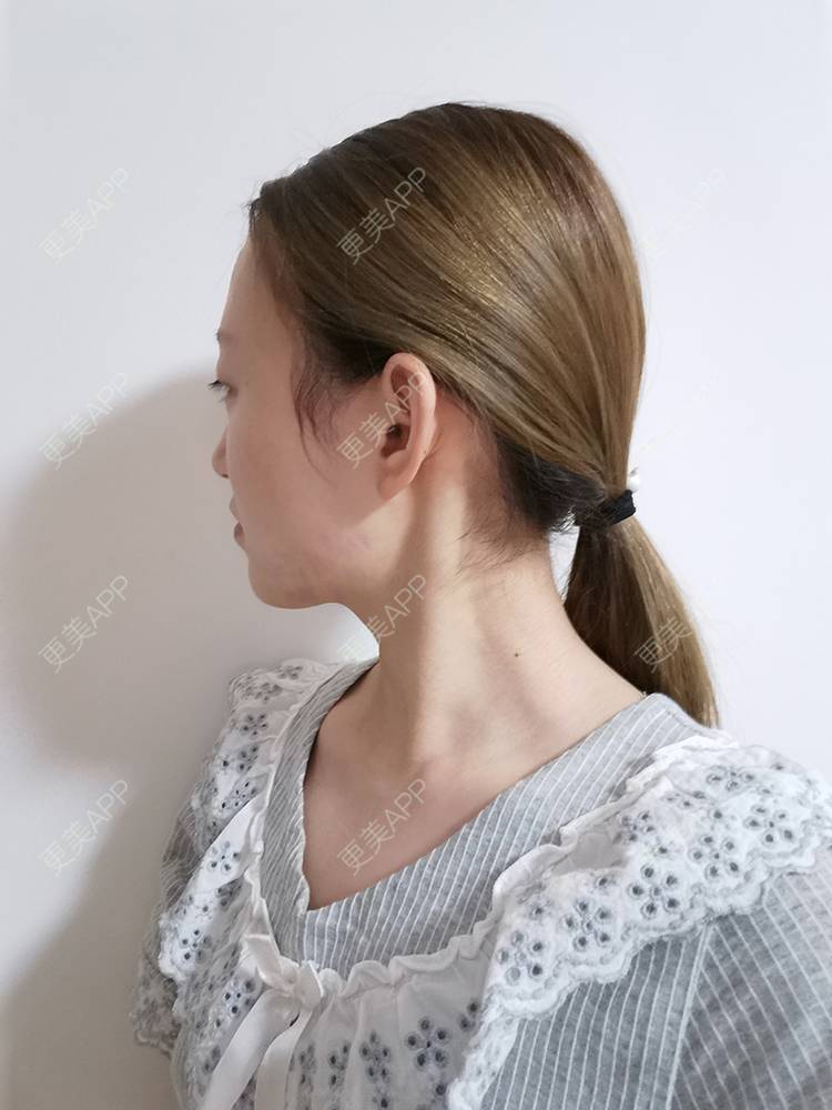 小美妞贝贝的下颌角日记