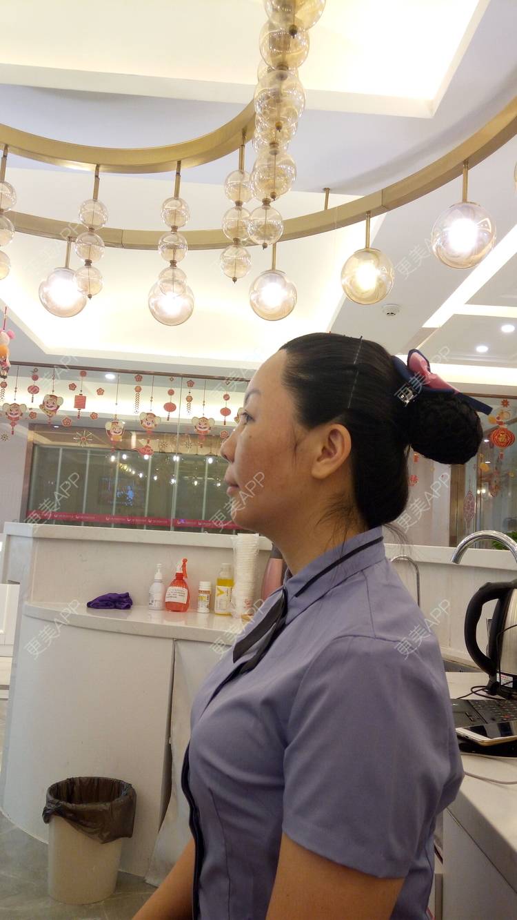 更美 - 更美用户u3zFY6hL8g的自体脂肪全面部填充经验 | 视频日记 | 深圳 | 自体脂肪全面部填充