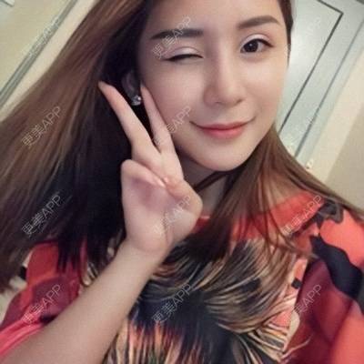 更美 - Imiss you的宽下巴矫正经验 | 玻尿酸下巴 | 下巴截骨前移 | 硅胶垫下巴 | 膨体垫下巴 | 宽下巴矫正 | 自体脂肪丰太阳穴 | 硅胶丰太阳穴 | 膨体丰太阳穴 | 人工骨垫下巴 | 成都